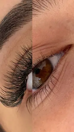 Antes e depois 