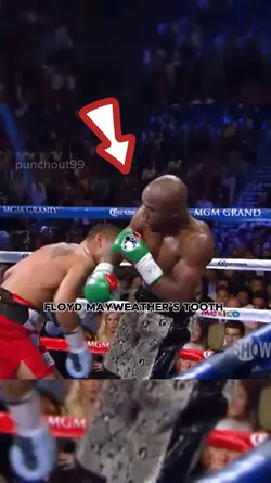 Floyd's Flying Tooth