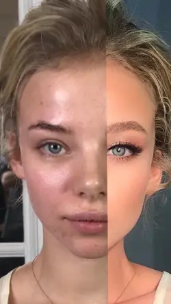 Antes e depois 