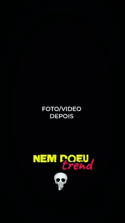 Nem doeu/trend