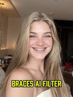 braces filter