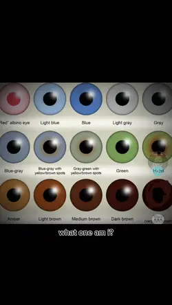 My eyeee