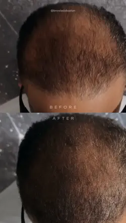 SMP before after