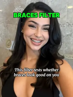 NEW Braces Filter 