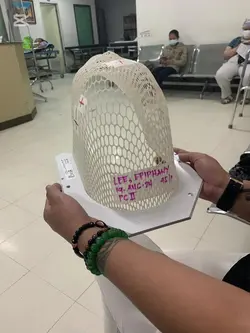 radiation treatment
