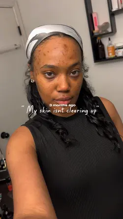 Skincare Template 🥒🫧