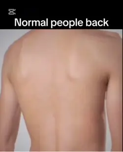Normal people back