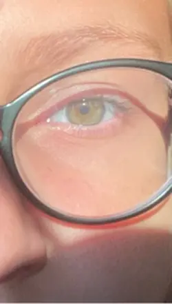 😍👁️