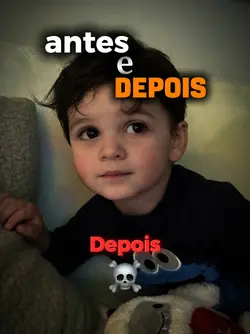 antes e depois