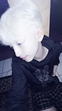 JJ 2 foto albino