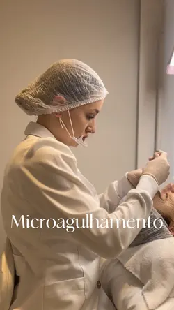 Microagulhamento 