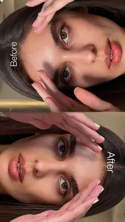 before & after