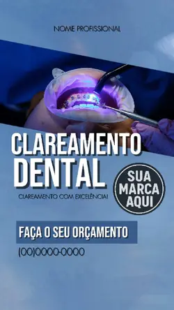 Anúncio
