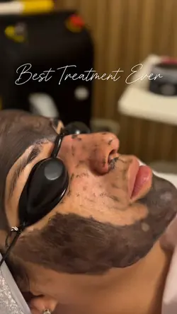 Carbon Peel