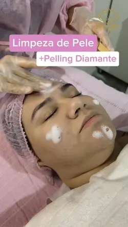 Peeling de diamante 