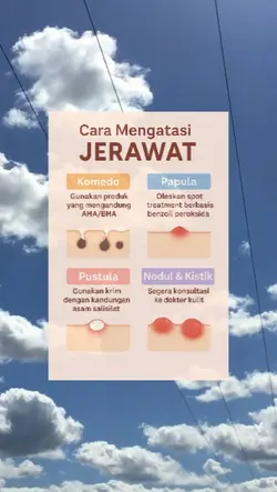 infografis video
