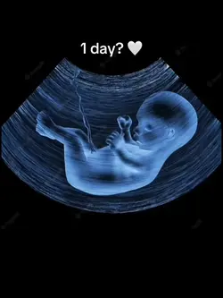 day 1