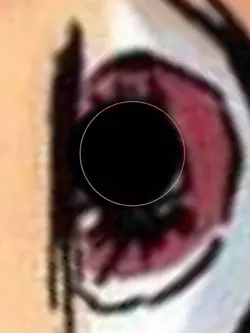 Black eyes