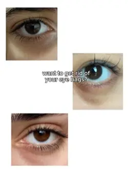 eye bag tut