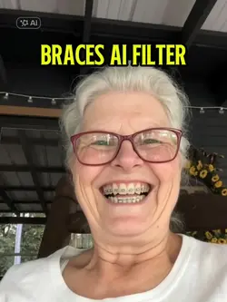 Braces Ai filter 