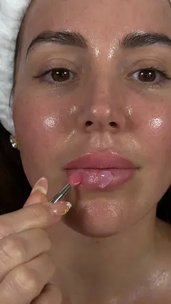 Lip treatment 