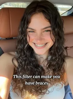 Braces filter