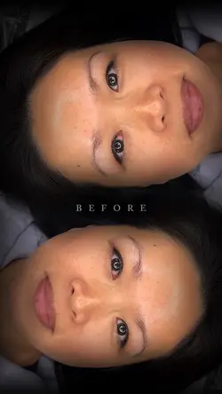 Before Mask