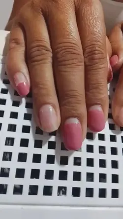 antes e depois