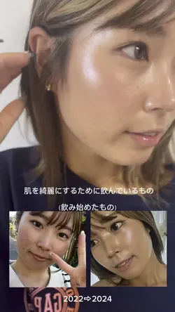 肌改善