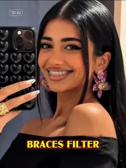 braces filter 