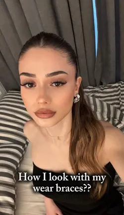 wear braces trend 