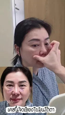 เพิ่ม 2 คลิป