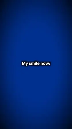 My smile