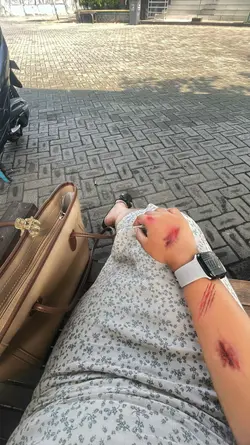 Prank luka ai