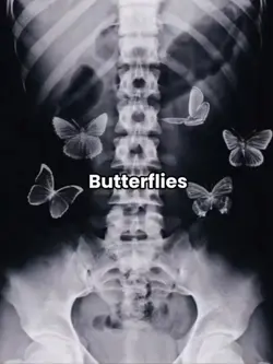 butterflies