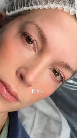 Brow transition