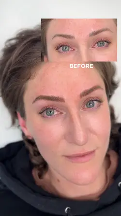 Before After Brows 