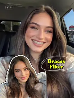 Braces Effect