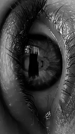 Eye