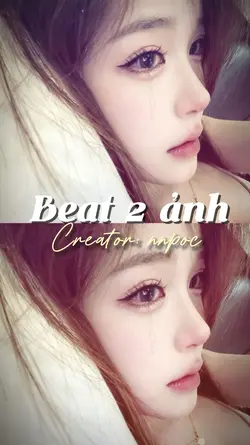 Beat 2 ảnh 