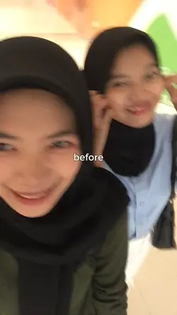 before after 