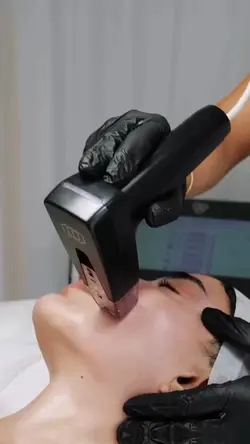 Microneedling aesthe