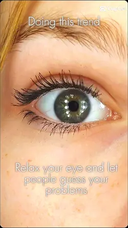 eyeball