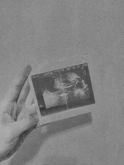 gender reveal | girl