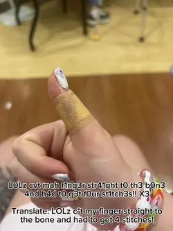 GOT A LIL BOO-BOO!!!