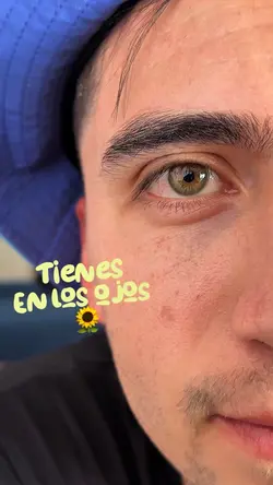 Ojos de girasol 🌻