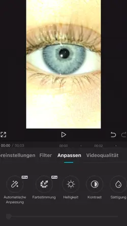 Eyes