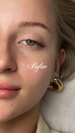 Eyelash before&after