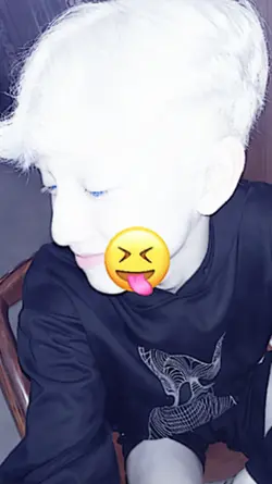 trend JJ albino