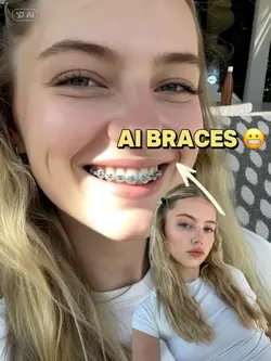 AI Braces 